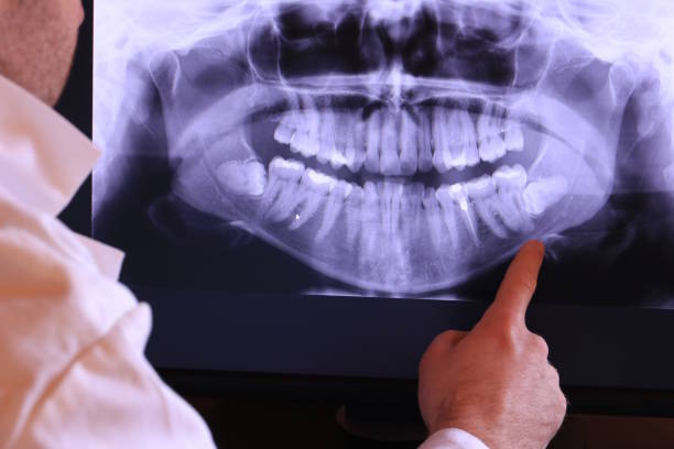 Best Emergency Dental Care for Broken or Chipped Teeth in Rockwall, TX